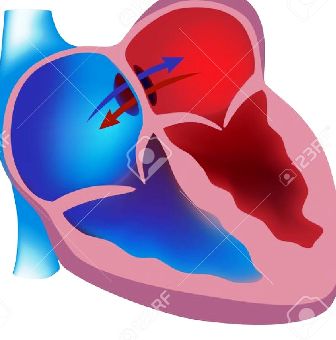 DECISÃO: Reconhecido direito de paciente para realização de cirurgia para correção de defeito congênito no coração